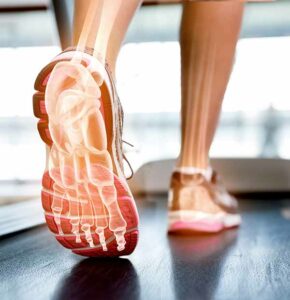 Foot Biomechanics and Orthotics Issues