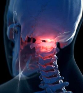 Upper Cervical and TMJ and Vestibular Issues